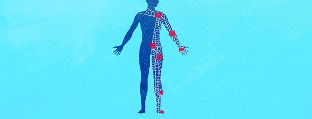 Dealing With Nerve Pain, A Personal Perspective image