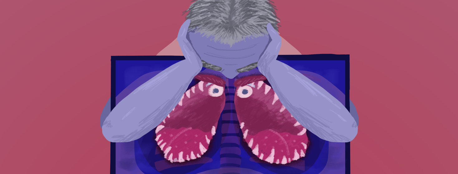 Coping with Scanxiety: A Lung Cancer Patient's Guide image