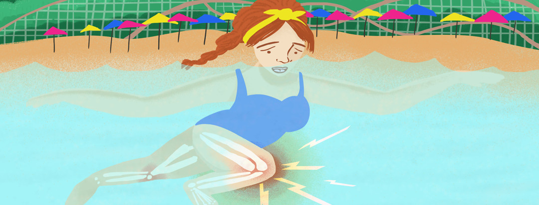 Woman with red hair in a blue swimsuit swims in a pool at Hurricane Harbor in Six Flags. Her knee is red and inflamed with yellow bolts of pain emanating from it into the water.