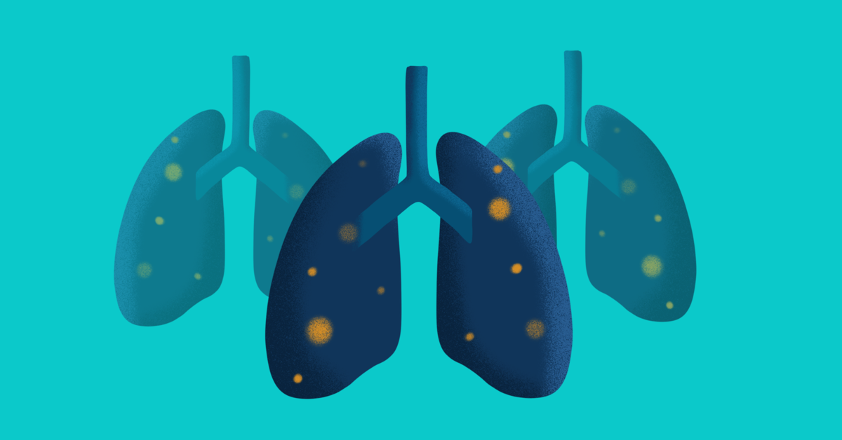 What Are the Different Types of Lung Cancer?