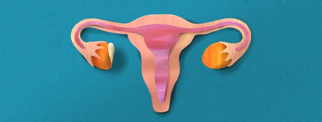 Hysterectomy, Hormones, and Hope image