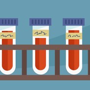 A rack of blood test tubes