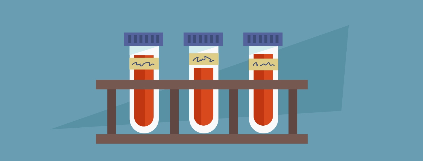 A rack of blood test tubes