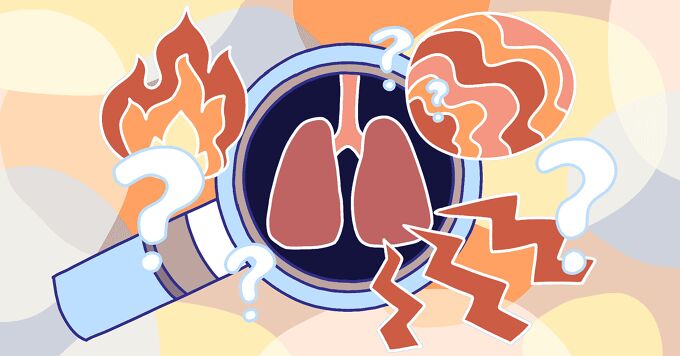 Pathophysiology of Lung Cancer image